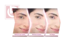 Glow & Lovely Advanced Multi Vitamin Serum in Cream 18g - Image 2